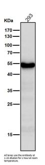 Anti-PAX6 Rabbit Monoclonal Antibody