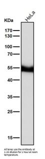 Anti-PAX6 Rabbit Monoclonal Antibody