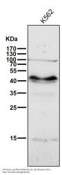 Anti-PAX6 Rabbit Monoclonal Antibody