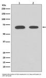 Anti-Chk2 CHEK2 Rabbit Monoclonal Antibody
