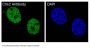Anti-Chk2 CHEK2 Rabbit Monoclonal Antibody