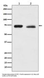 Anti-NF2 / Merlin Monoclonal Antibody