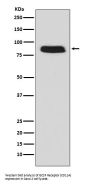 Anti-GCSF Receptor (CD114) Monoclonal Antibody