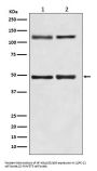 Anti-NF-Kappa B (p105/p50) NFKB1 Rabbit Monoclonal Antibody