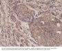 Anti-NFkB p65 RELA Rabbit Monoclonal Antibody, Clone#RM273