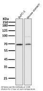 Anti-NF-Kappa B p65 RELA Rabbit Monoclonal Antibody