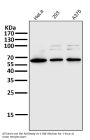Anti-NF-Kappa B p65 RELA Rabbit Monoclonal Antibody