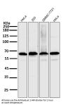 Anti-NF-Kappa B p65 RELA Rabbit Monoclonal Antibody