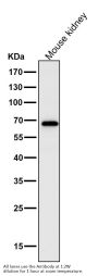 Anti-NF-Kappa B p65 RELA Rabbit Monoclonal Antibody