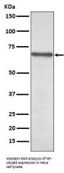 Anti-NF-Kappa B p65 RELA Rabbit Monoclonal Antibody