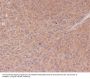 Anti-NF-Kappa B p65 RELA Rabbit Monoclonal Antibody