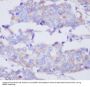 Anti-MMP2 Rabbit Monoclonal Antibody