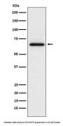 Anti-MMP2 Monoclonal Antibody
