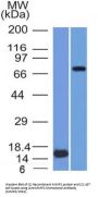 Anti-MMP2 / Collagenase Type IV A (Tumor Metastasis Marker) Monoclonal Antibody