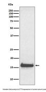 Anti-TTR/Prealbumin Rabbit Monoclonal Antibody
