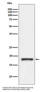 Anti-Prealbumin TTR Rabbit Monoclonal Antibody