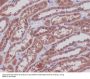 Anti-MEK1/2 MAP2K1 Rabbit Monoclonal Antibody