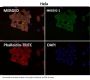 Anti-MEK1/2 MAP2K1 Rabbit Monoclonal Antibody