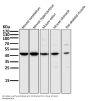 Anti-MEK1 MAP2K1 Rabbit Monoclonal Antibody