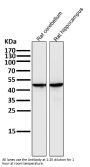 Anti-MEK1 MAP2K1 Rabbit Monoclonal Antibody