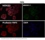 Anti-MEK1 MAP2K1 Rabbit Monoclonal Antibody