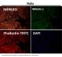 Anti-MEK1 MAP2K1 Rabbit Monoclonal Antibody