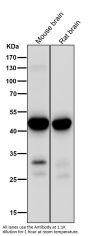 Anti-MEK1 MAP2K1 Rabbit Monoclonal Antibody