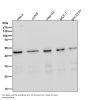 Anti-MEK1 MAP2K1 Rabbit Monoclonal Antibody