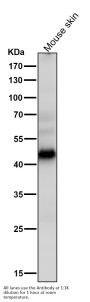 Anti-MEK1 MAP2K1 Rabbit Monoclonal Antibody