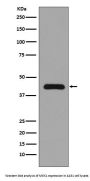 Anti-MEK1 MAP2K1 Rabbit Monoclonal Antibody