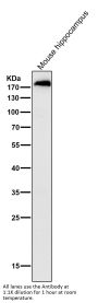 Anti-ErbB (HER4) ERBB4 Rabbit Monoclonal Antibody