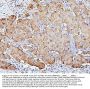 Anti-SQSTM1/p62 Antibody Picoband® (monoclonal, 3H11)