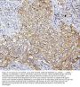 Anti-SQSTM1/p62 Antibody Picoband® (monoclonal, 3H11)