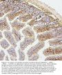 Anti-SQSTM1/p62 Antibody Picoband® (monoclonal, 3H11)