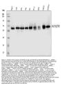 Anti-SQSTM1/p62 Antibody Picoband® (monoclonal, 3H11)