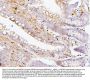 Anti-SQSTM1/p62 Antibody Picoband® (monoclonal, 3H11)