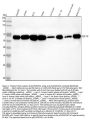 Anti-p62/SQSTM1 Rabbit Monoclonal Antibody