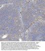 Anti-p62/SQSTM1 Rabbit Monoclonal Antibody