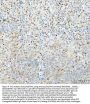 Anti-p62/SQSTM1 Rabbit Monoclonal Antibody