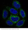 Anti-p62/SQSTM1 Rabbit Monoclonal Antibody