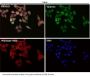 Anti-p62/SQSTM1 Rabbit Monoclonal Antibody