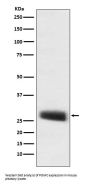 Anti-POMC Monoclonal Antibody