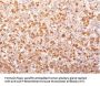 Anti-ACTH (Adrenocorticotrophic Hormone) (N-Terminal) (Pituitary Marker) Monoclonal Antibody