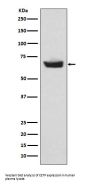 Anti-CETP Rabbit Monoclonal Antibody
