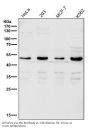 Anti-Lipoprotein lipase LPL Rabbit Monoclonal Antibody