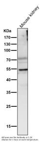 Anti-Lipoprotein lipase LPL Rabbit Monoclonal Antibody