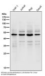 Anti-Lipoprotein lipase LPL Rabbit Monoclonal Antibody