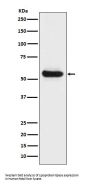 Anti-Lipoprotein lipase LPL Rabbit Monoclonal Antibody