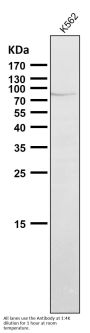 Anti-PI 3 Kinase p85 alpha PIK3R1 Rabbit Monoclonal Antibody