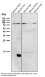 Anti-PI 3 Kinase p85 alpha PIK3R1 Rabbit Monoclonal Antibody